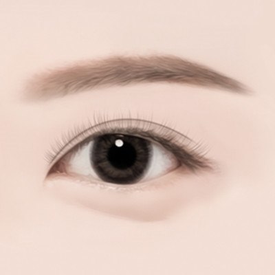 STEP 04 수술 후 또렷한 눈매로 완성됩니다.