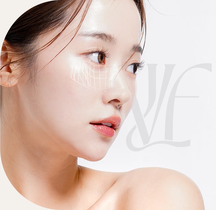 눈 밑 부위에 리프팅 그리드를 표시한 여성 옆모습