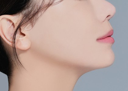 STEP 06 수술 후 입체적이고 생기 있는 얼굴로 개선됩니다.