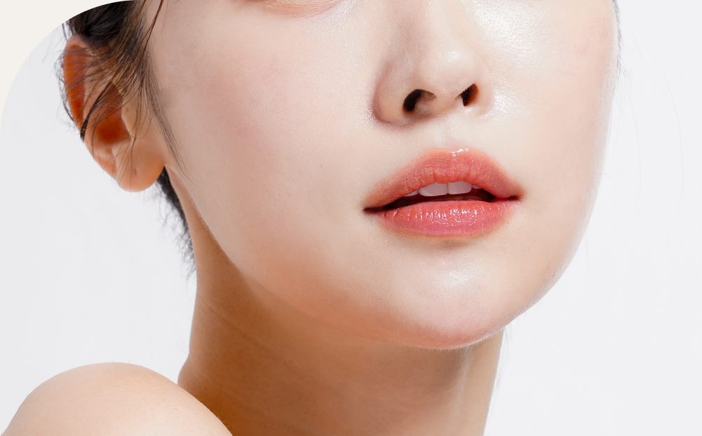 하안검과 중안면부 거상 부위를 표시한 얼굴