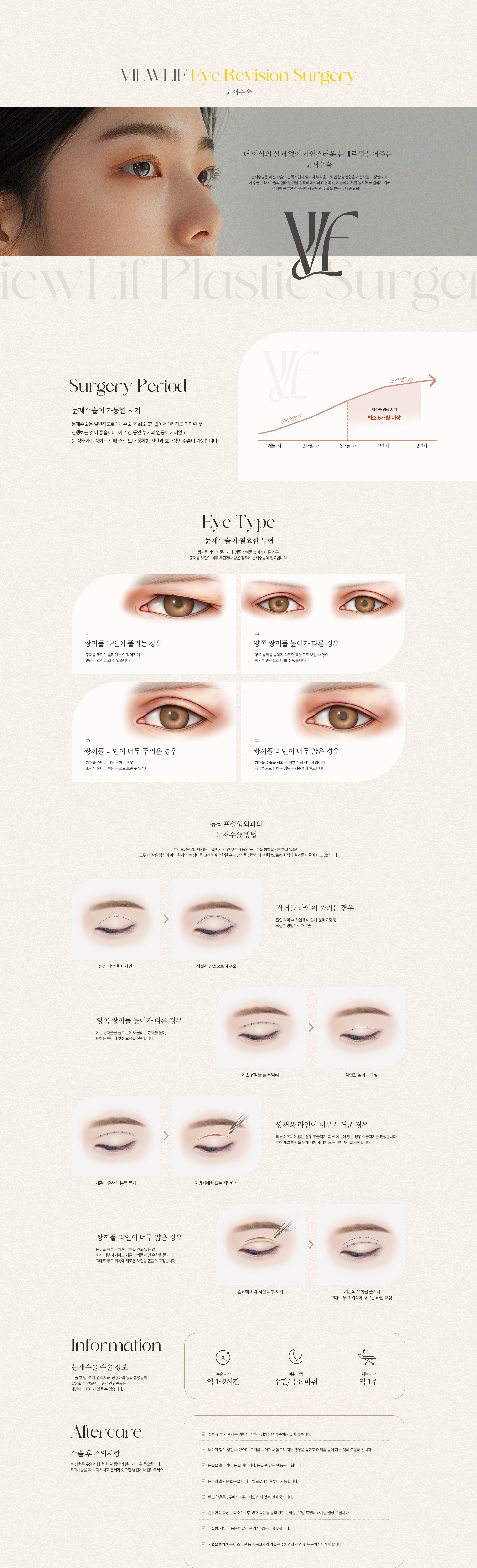 눈재수술